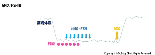 hMG/FSH法