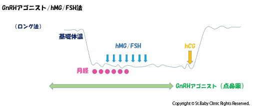 GnRHアゴニスト・hMG/FSH法（ロング法）