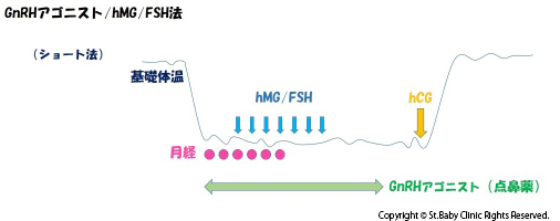 GnRHアゴニスト・hMG/FSH法（ショート法）